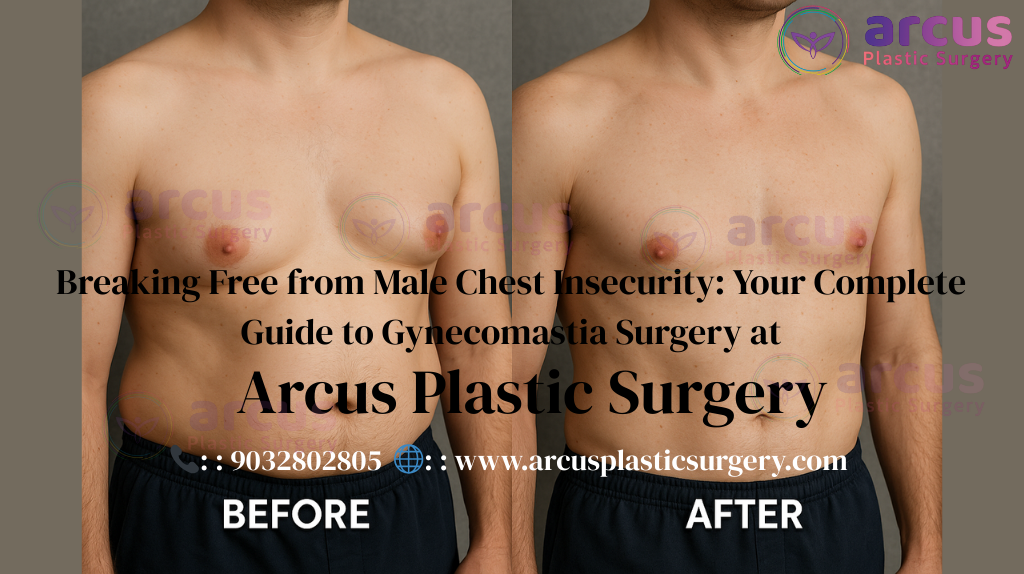Best Gynecomastia Surgery Clinic Near Indis Onecity