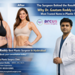 Dr Gautam Reddy Best Plastic Surgeon In Hyderabad