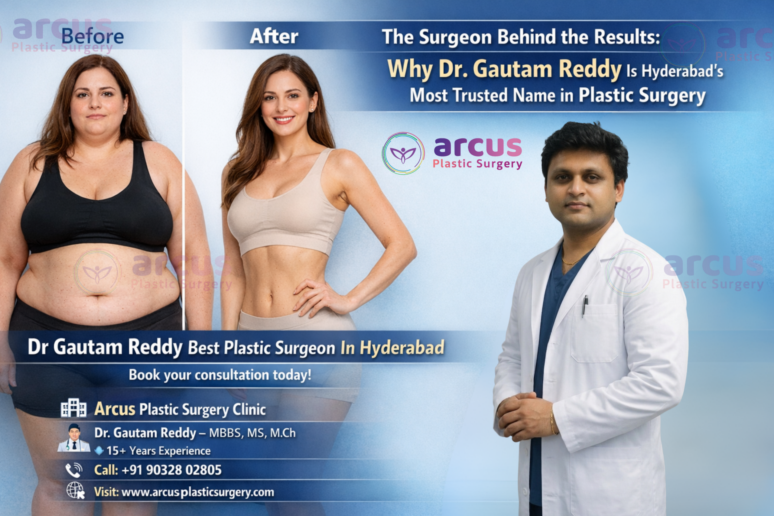 Dr Gautam Reddy Best Plastic Surgeon In Hyderabad