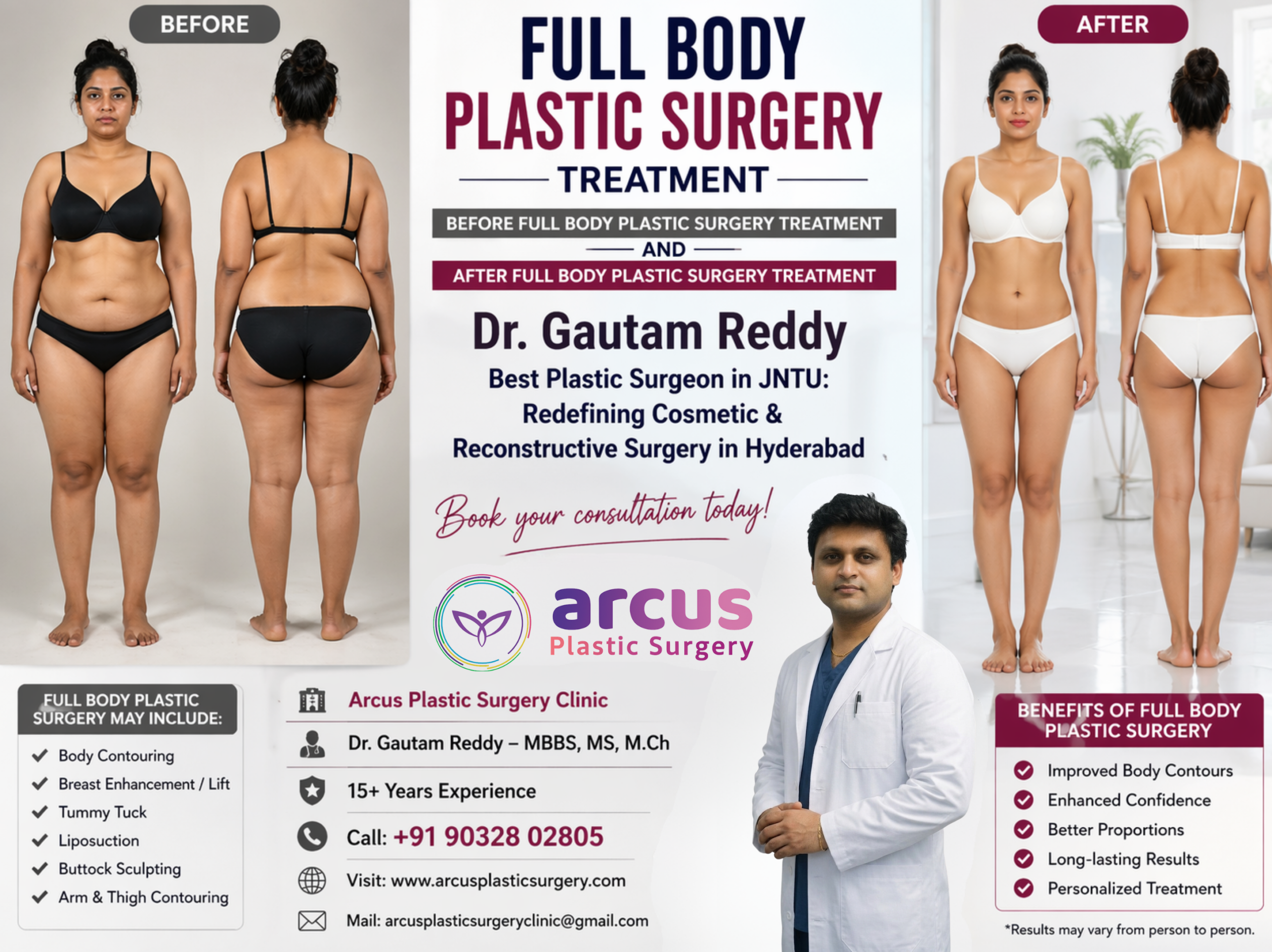 Dr Gautam Reddy Best Plastic Surgeon in JNTU