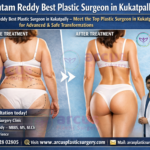 Dr Gautam Reddy Best Plastic Surgeon in Kukatpally