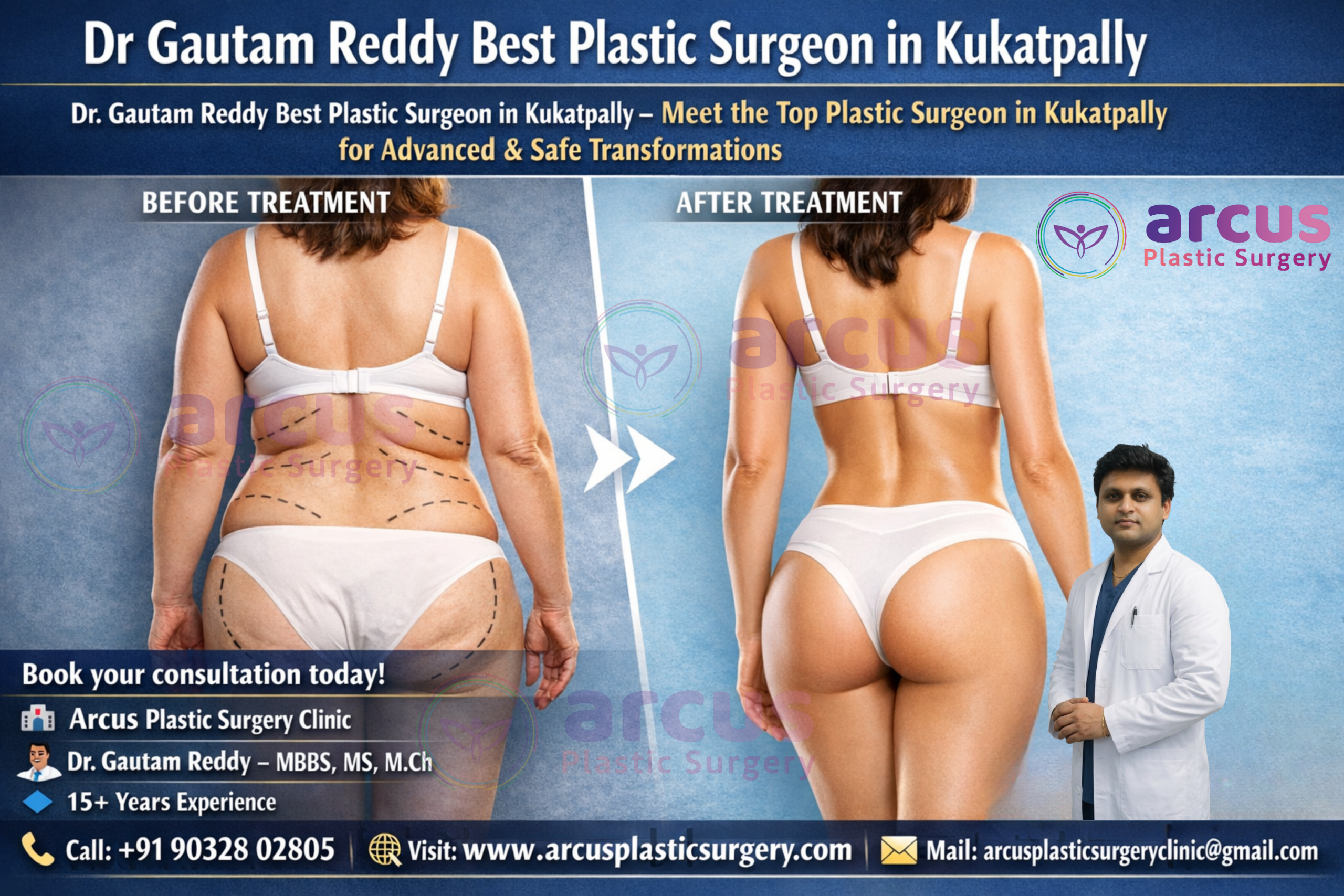 Dr Gautam Reddy Best Plastic Surgeon in Kukatpally
