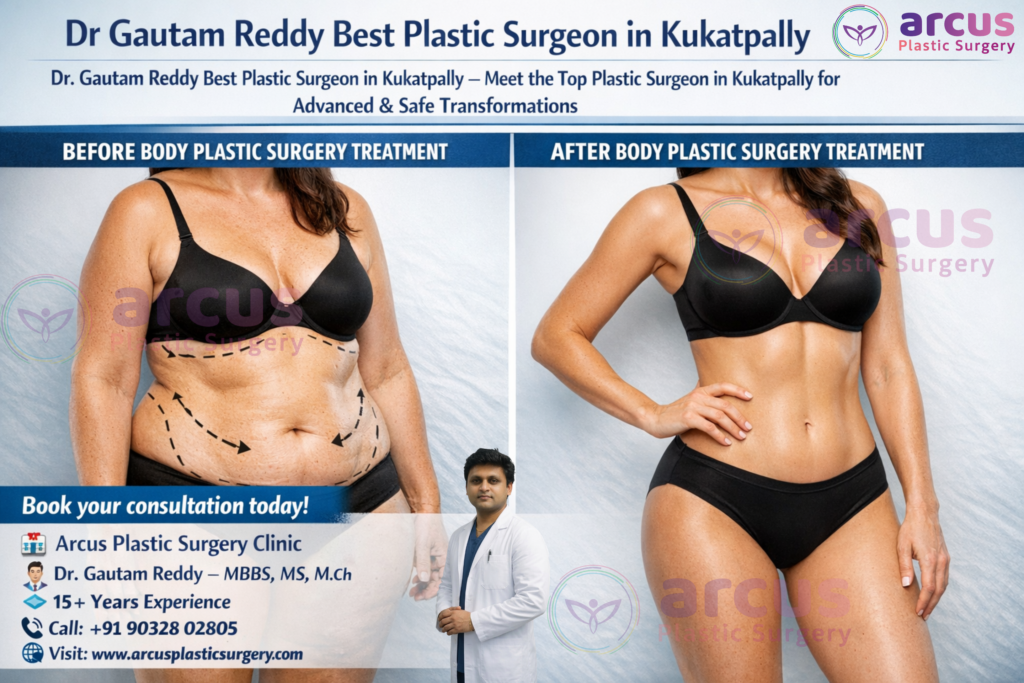 Dr. Gautam Reddy Best Plastic Surgeon in Kukatpally