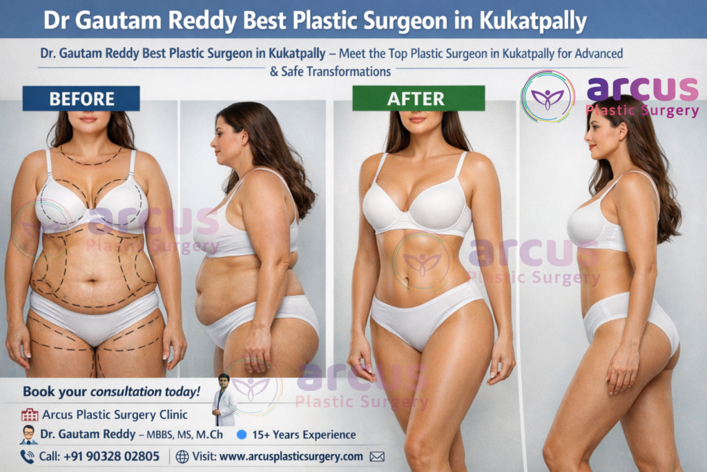 Dr. Gautam Reddy Best Plastic Surgeon in Kukatpally