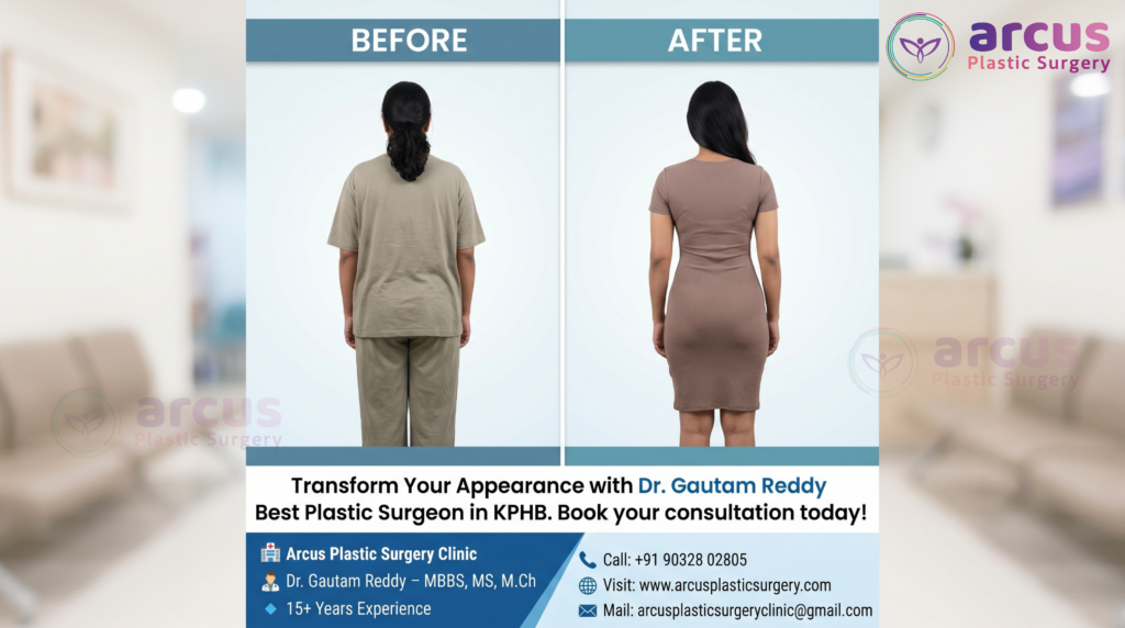 Dr. Gautam Reddy Top plastic Surgeon in KPHB