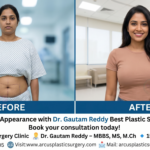 Dr. Gautam Reddy Best Plastic Surgeon in KPHB
