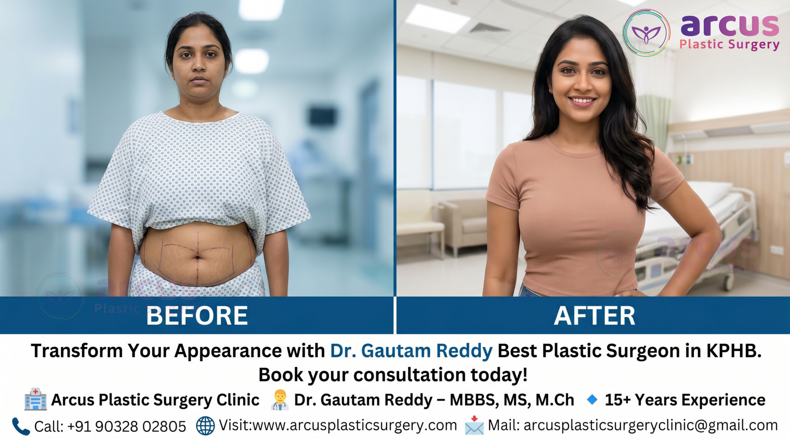 Dr. Gautam Reddy Best Plastic Surgeon in KPHB