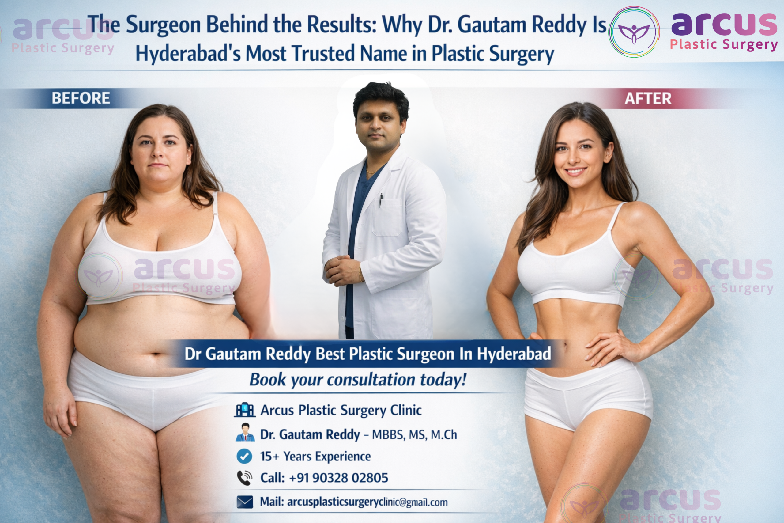 Dr Gautam Reddy Best Plastic Surgeon in Kondapur