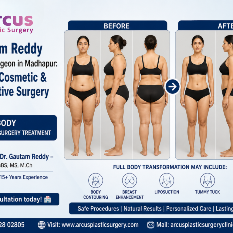 Dr. Gautam Reddy Best Plastic Surgeon In Madhapur