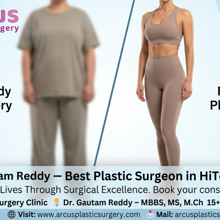 Dr. Gautam Reddy Best Plastic Surgeon in HiTech City
